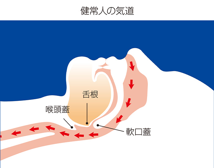 健常人の起動